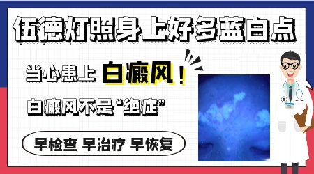 伍德灯下亮蓝白色就一定是白癜风吗