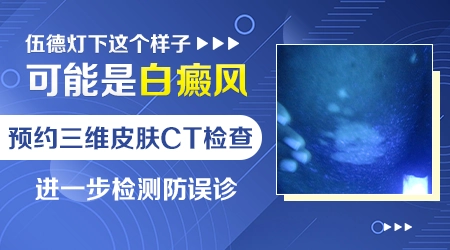 伍德灯显示浅白色荧光是什么