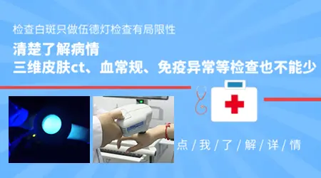 伍德灯显示蓝白色荧光边界清楚就是白癜风吗