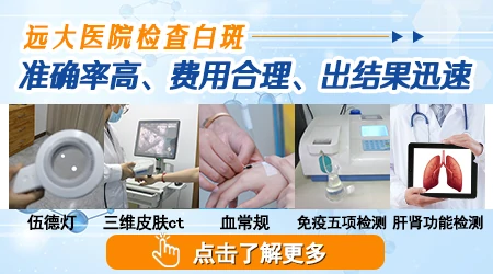 邯郸哪里检查白斑比较准确
