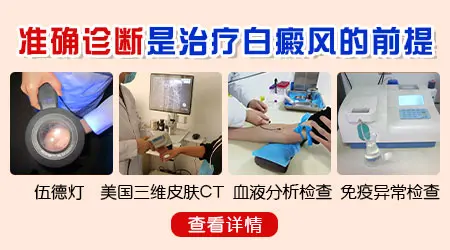 只看肉眼能确诊白癜风吗