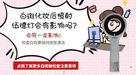 伍德灯检查前涂了化妆品会影响结果吗