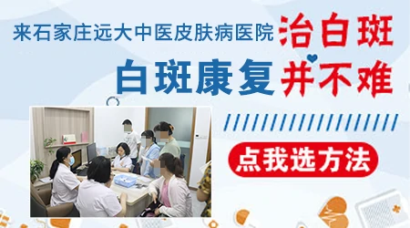 照伍德灯不同颜色的白斑分别代表什么