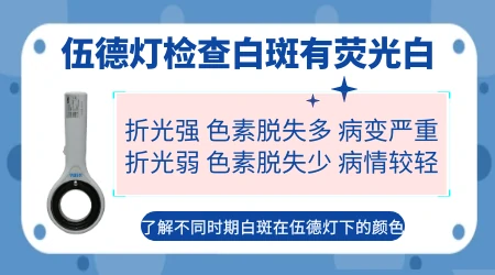 伍德灯结果显示淡白色荧光是黑色素脱失很少吗