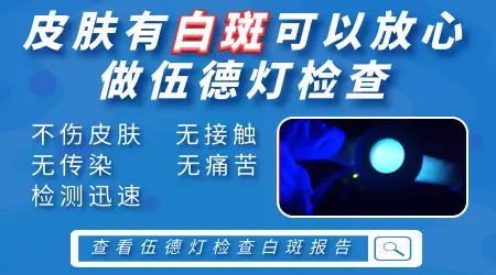 伍德灯下白斑模糊不清是处于进展期吗