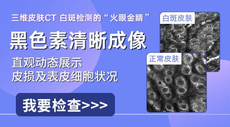 皮肤ct对检查白斑有什么作用 必须做吗