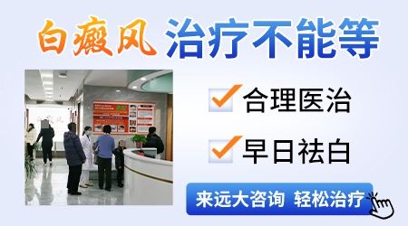 伍德灯下亮白色荧光就是确诊白癜风了吗