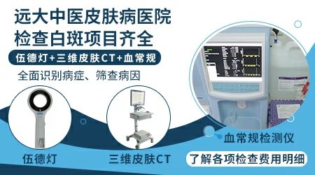 伍德灯能判断白斑是进展期还是稳定期吗
