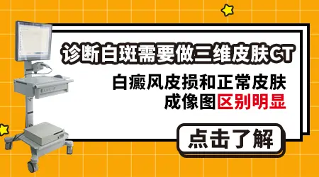 家用伍德灯和医院的检测白斑有什么区别
