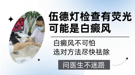 家用伍德灯和医院的检测白斑有什么区别