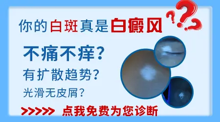 自己如何分辨白斑是不是白癜风