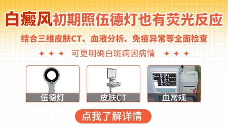伍德灯检查白斑初期准确率多少