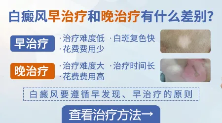 伍德灯下白斑有蓝白色荧光严重吗