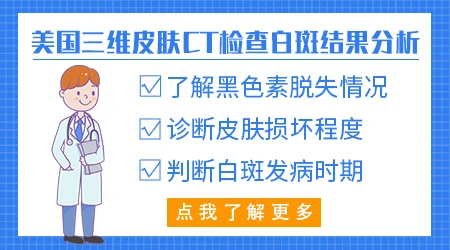 皮肤CT能区分白癜风和白色糠疹吗