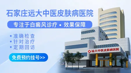 白斑相关检查大概需要多少钱