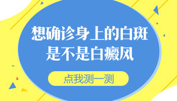 白癜风是什么症状怎么确认是白癜风