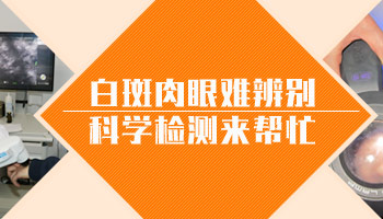 男性发际线的位置白了一块如何判断是不是白癜风