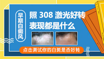 308激光照射白斑后呈现粉红色是在好转吗