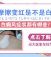 用力搓白癜风会发红吗