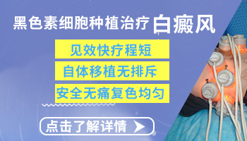 白癜风静止期是怎样判断