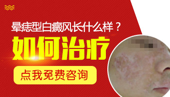 晕痣初期症状表现是什么 晕痣早期的图片