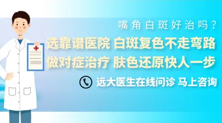 嘴唇白癜风图片 唇边白斑怎么治