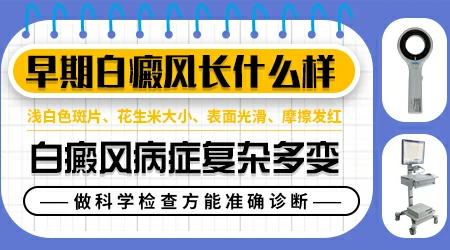 白癜风最初期的症状表现都有哪些