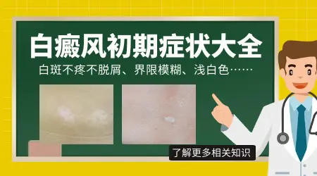白癜风刚长出来时样子图片