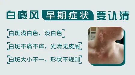 白癜风早期症状图片 皮肤出现这个信号要警惕