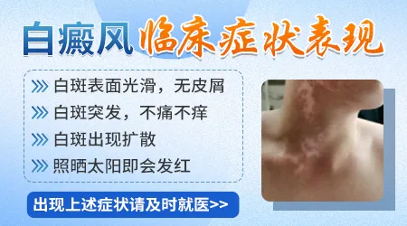 白癜风有哪些典型症状表现