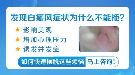脸上长白癜风初期什么样子图片