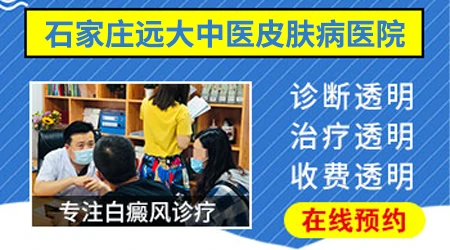 白癜风图片鉴别与自测 3分钟在家完成白斑筛查