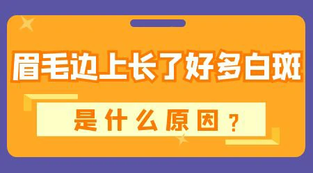 眉毛局部变白是不是白癜风早期信号