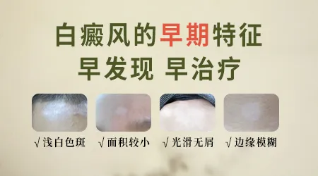手肘出现米粒大小的白点是白癜风的早期表现吗