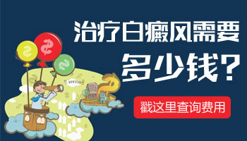 治白癜风的中药多少钱一包