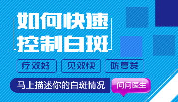 不规则形状的白癜风好控制吗