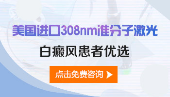 手指甲盖大小的白癜风做308激光收费贵吗