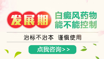 发展期白癜风照311效果怎么样