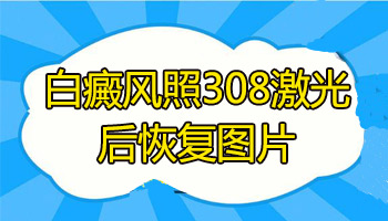 做完308激光后白斑部位又红又痒正常吗