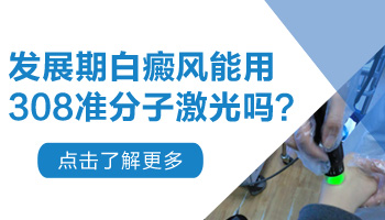 白癜风扩散期可以照308激光吗