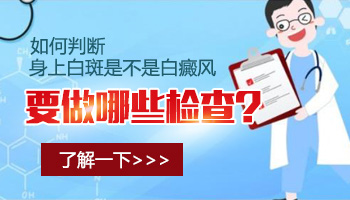 白癜风早期会检查不出来吗 查白斑都做什么检查