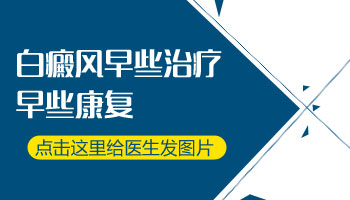 2019年邯郸白癜风自愈新方法都有哪些