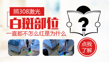 308激光照了白斑皮肤不发红是什么原因