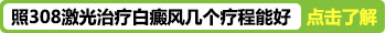 308激光治疗白癜风多久是一个疗程