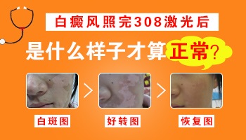 孩子白斑照308不红是什么原因