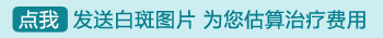 照射308激光治疗白斑价格表