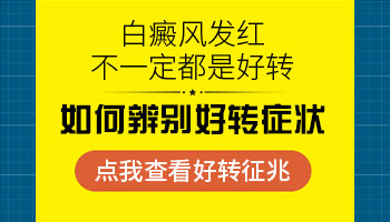 做完308白癜风发红是好事吗