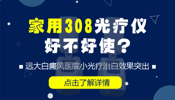 家用半岛308nm准分子光疗仪治白癜风效果怎么样