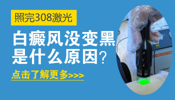 嘴周围白癜风照了激光只发红不变黑是为什么