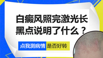 白癜风照308激光后有黑点长出来是有好转吗